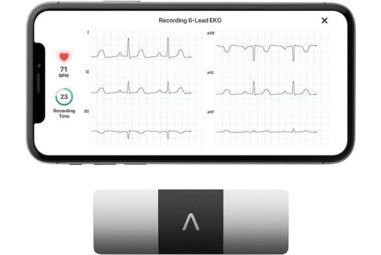 KardiaMobile 6-Lead EKG Monitor Review